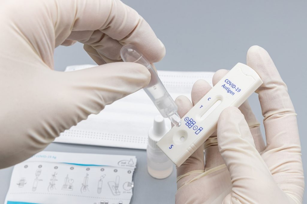 Covid 19 Rapid Test Diagnostic